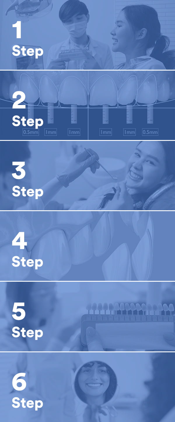 Our Dental Veneers Treatment Process